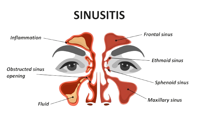 Illustration of sinus problems and ear ringing, representing common health issues affecting the nose and ears
